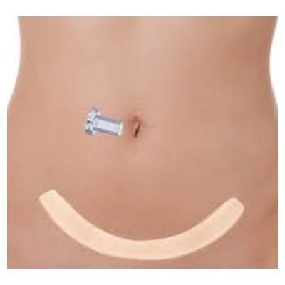 Pós-cirurgico - Imagem 12