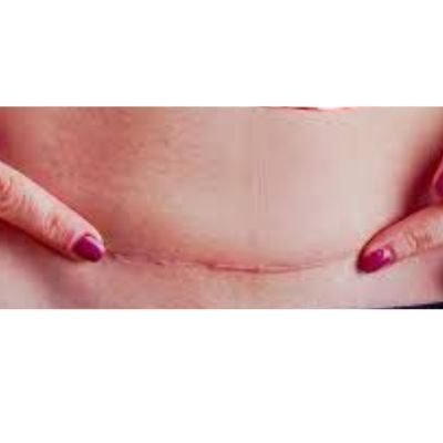 Pós-cirurgico - Imagem 15